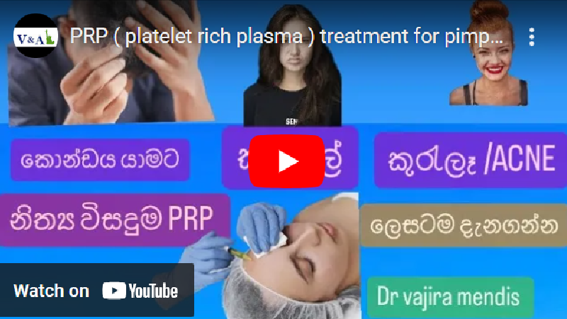 4) PRP ලෙසටම දැනගමු